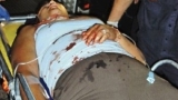 Corrientes: joven fue agredida de 16 puñaladas y está grave