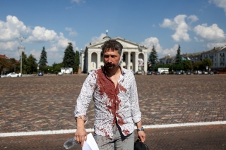 Un hombre herido sale del lugar de un ataque con misiles, cerca del Teatro Regional Académico de Música - Ucrania